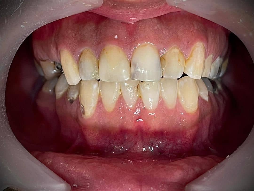 نمونه کار دندان